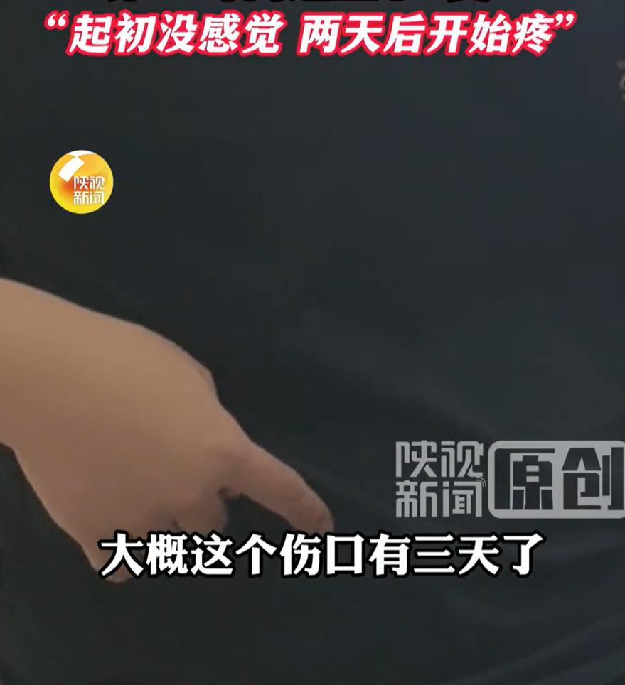 担心的事情还是发生了！陕西西安，男子在家休息时，突然觉得肚皮有点痒，就随手抓了几