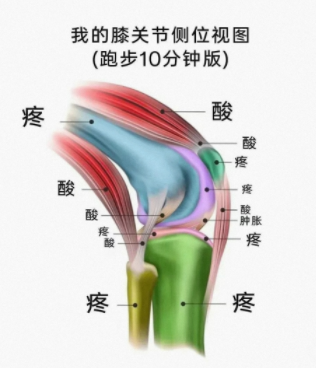 我的膝关节侧位视图
