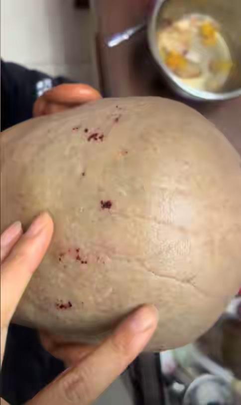 “又好气又好笑！”天津，67岁大爷花10元剃头，结果剔完满头都是伤口，女儿想找店