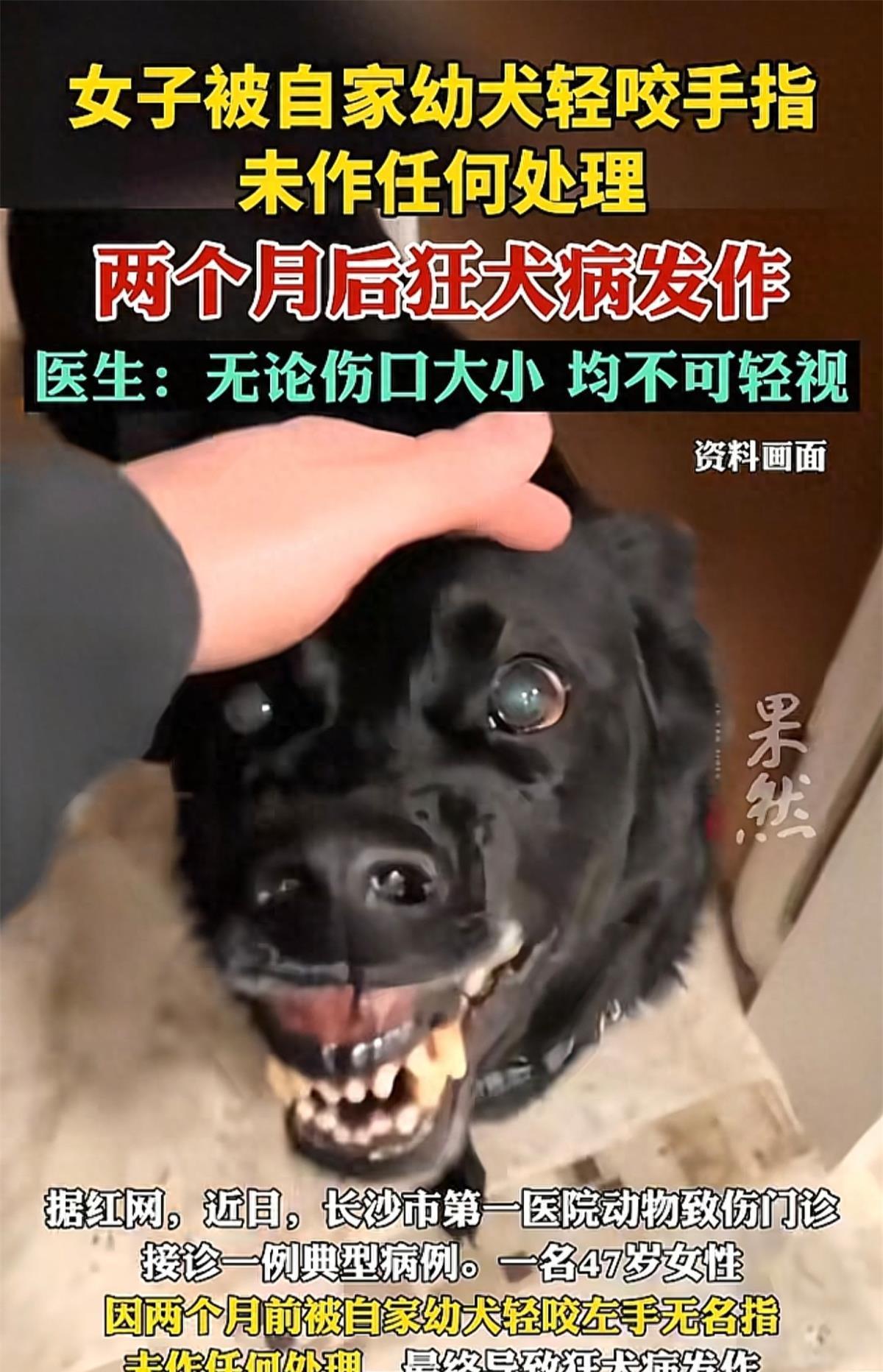 47岁女子被幼犬轻咬两个月后死亡，狂犬病发作无药可救！长沙47岁的李女士被自