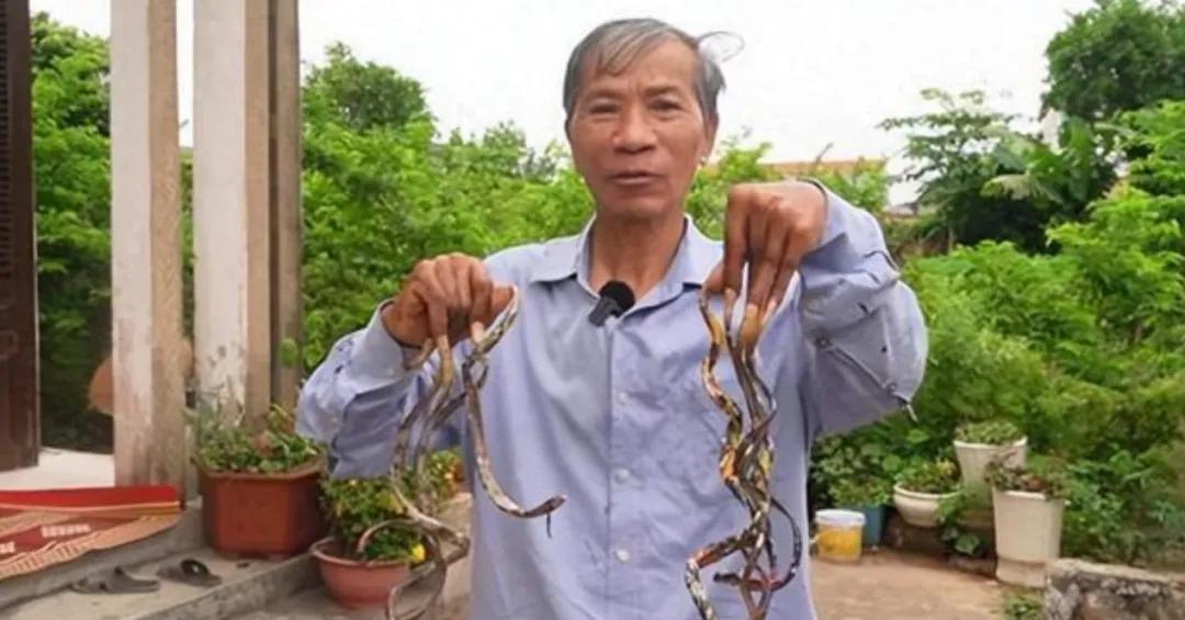 实在是奇葩！越南67岁的男子，34年来，都不愿意剪指甲，洗澡穿衣全需要靠妻子帮忙