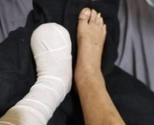 “谁该为这条命负责？”一个天津男人，在菲律宾待了二十年，因严重糖尿病左脚五趾截除