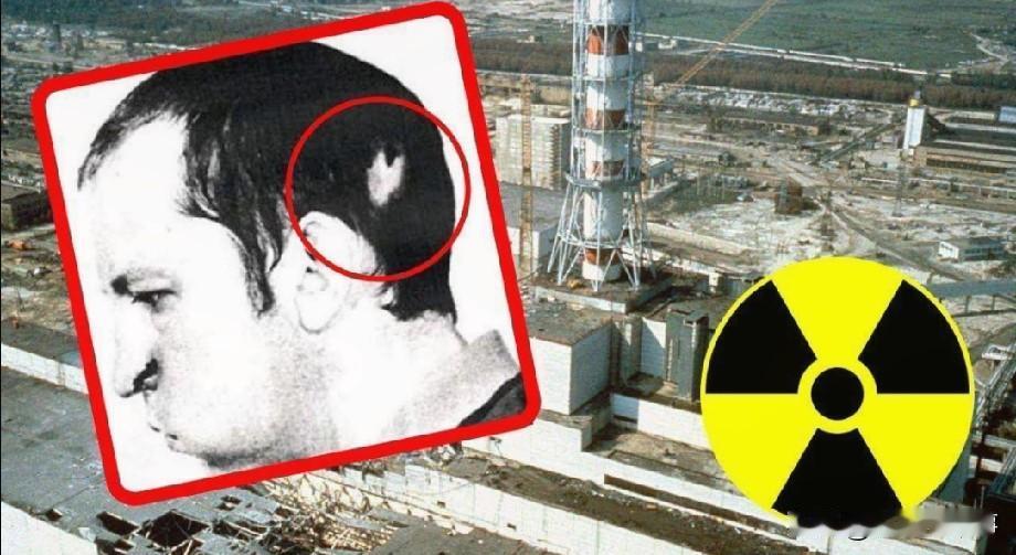 1978年，苏联一位物理学家，不小心被高辐射的粒子光速击穿脑袋，然而，奇迹发生了