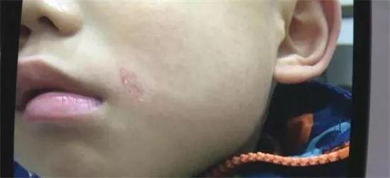 孩子之间闹矛盾家长帮忙出口气, 没想到后果却会很严重