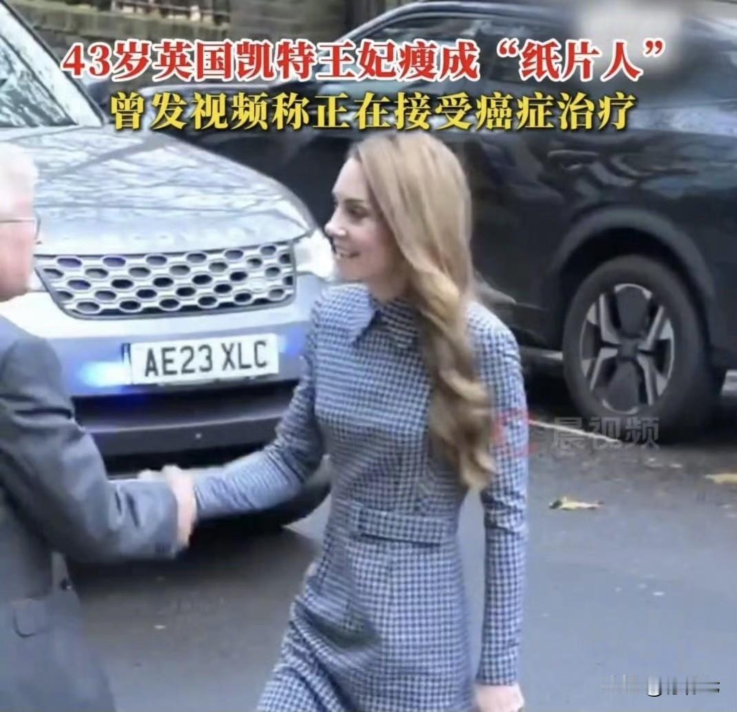 全球关注‼️43岁英国王妃凯特瘦成纸片人仍优雅亮相，眼神坚定惹全球祝福近日43
