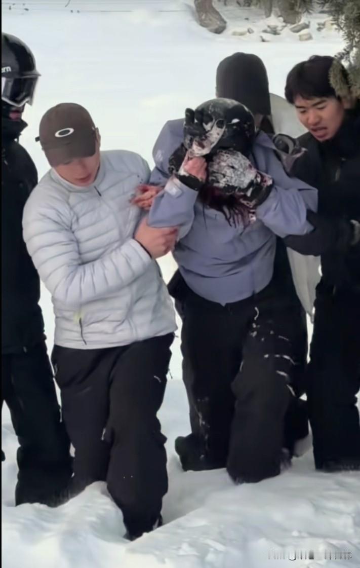 不知道有人注意到没有，雪豹伤人事发地雪非常厚。从新闻中看到了滑雪女游客在新疆富