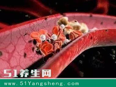 它被称为天然血管“清道夫”, 常吃血液不粘稠, 血管不堵塞!