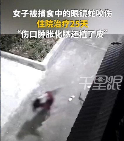 “命真大啊！”云南红河，女子在院子里乘凉时，意外被捕食癞蛤蟆的眼镜蛇咬到脚，不到