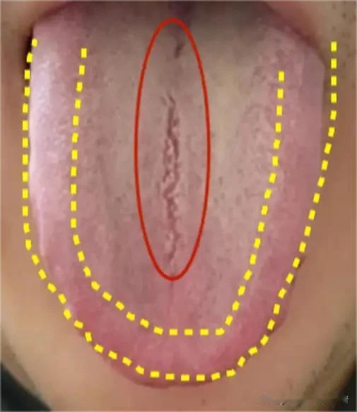 脾虚+肾虚+湿热+肝郁同存？4味药精准调，不盲目清利、不妄补阳气大家好，我