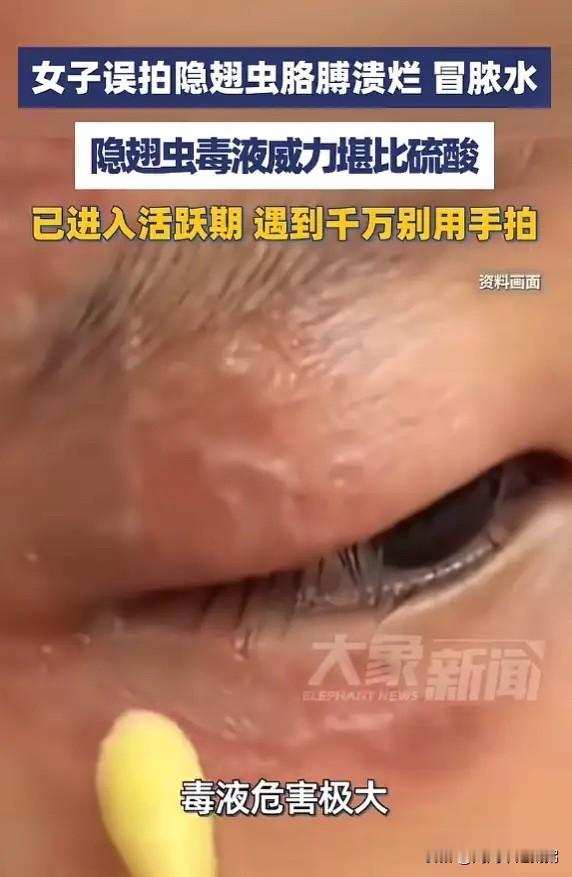真的后怕！5月29日，浙江义乌一位女士在家窗边撞见一只小飞虫，下意识抬手就拍。谁