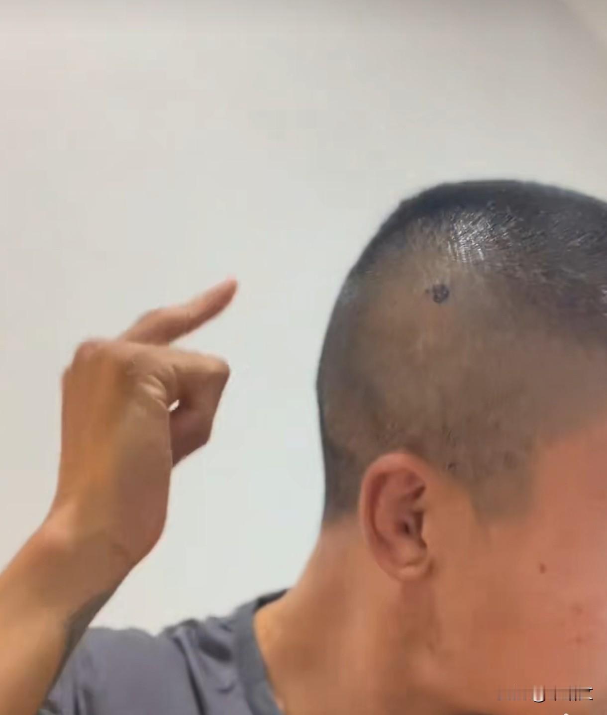 中国拳王澳洲遭围殴！为护妻被锥子扎头，为啥手握金腰带却不还手？今儿个刷着新