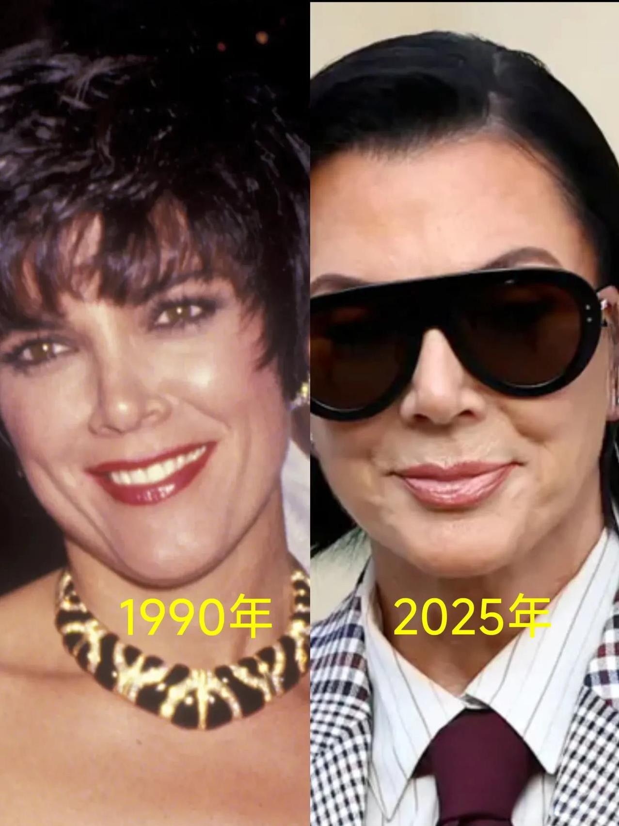 金.卡戴珊的老妈终于在2025年时，经过整形成功把自己整成了和二女儿金.卡戴珊一