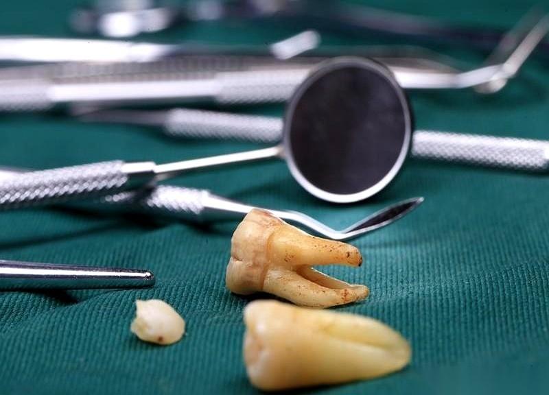 谁懂啊，半夜牙疼到想撞墙的那种绝望。我以前就那样，跟牙疼是老朋友了，隔三差五来