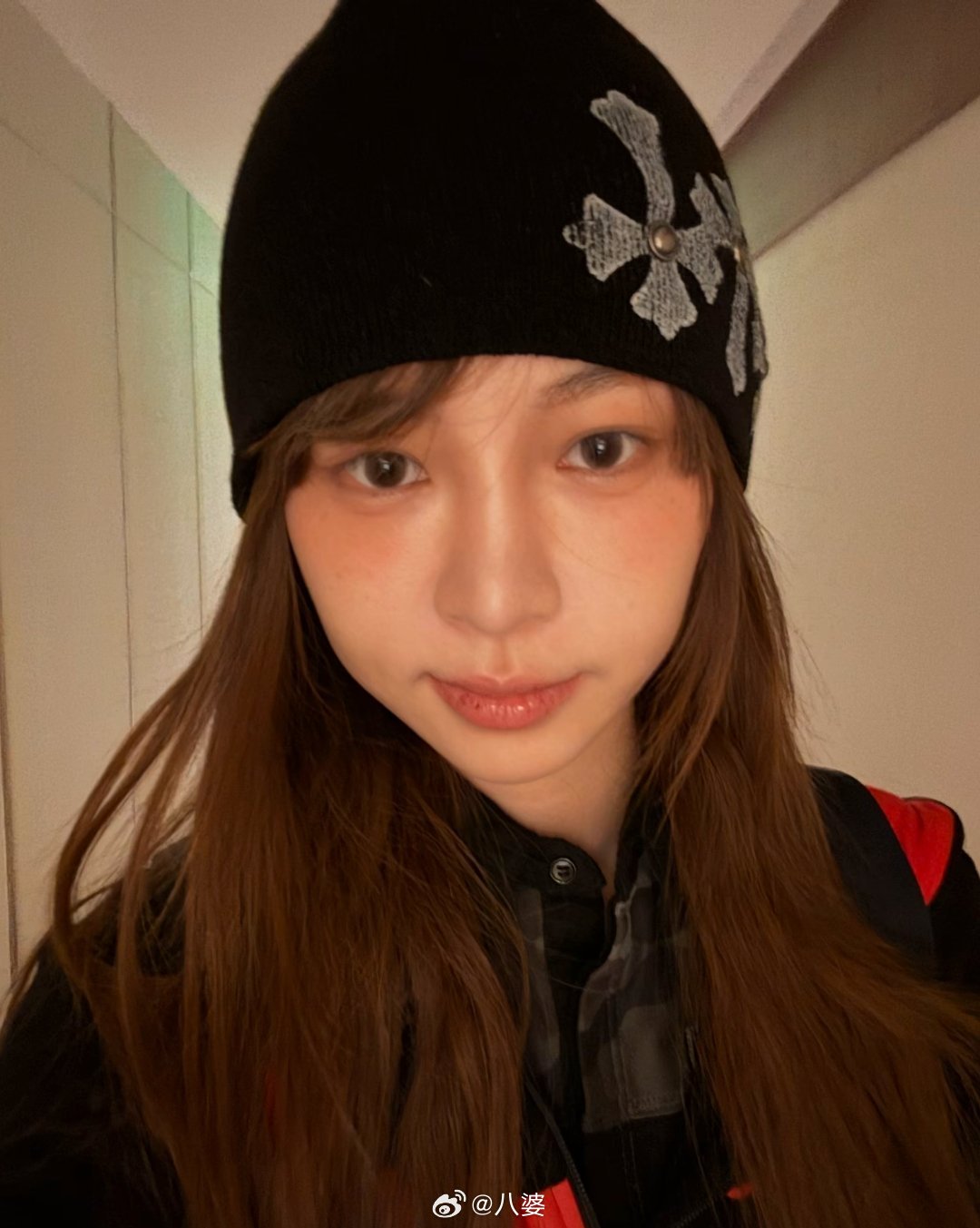 痞幼做医美了额没有人觉得这个人发的很有引导性吗？痞幼就做个法令纹，这不就是属于保