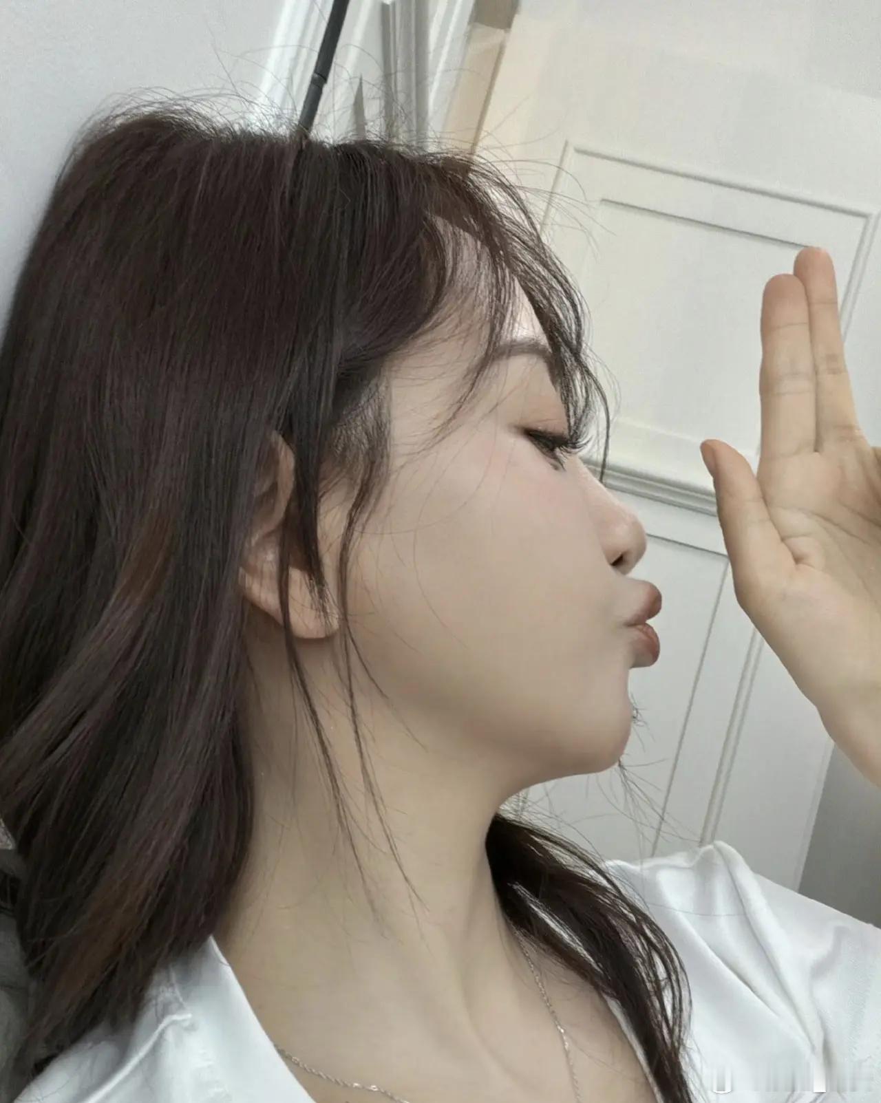 杨蓉面部烫伤恢复近照杨蓉面部烫伤恢复近照太飒了！带疤的脸很酷，姐姐的通透才是真美