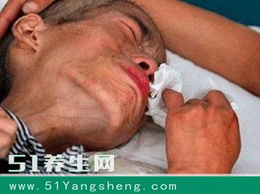 一家3口人因长期吃这道菜, 结果全部患癌住院, 大部分的家庭经常在吃, 要警惕了!