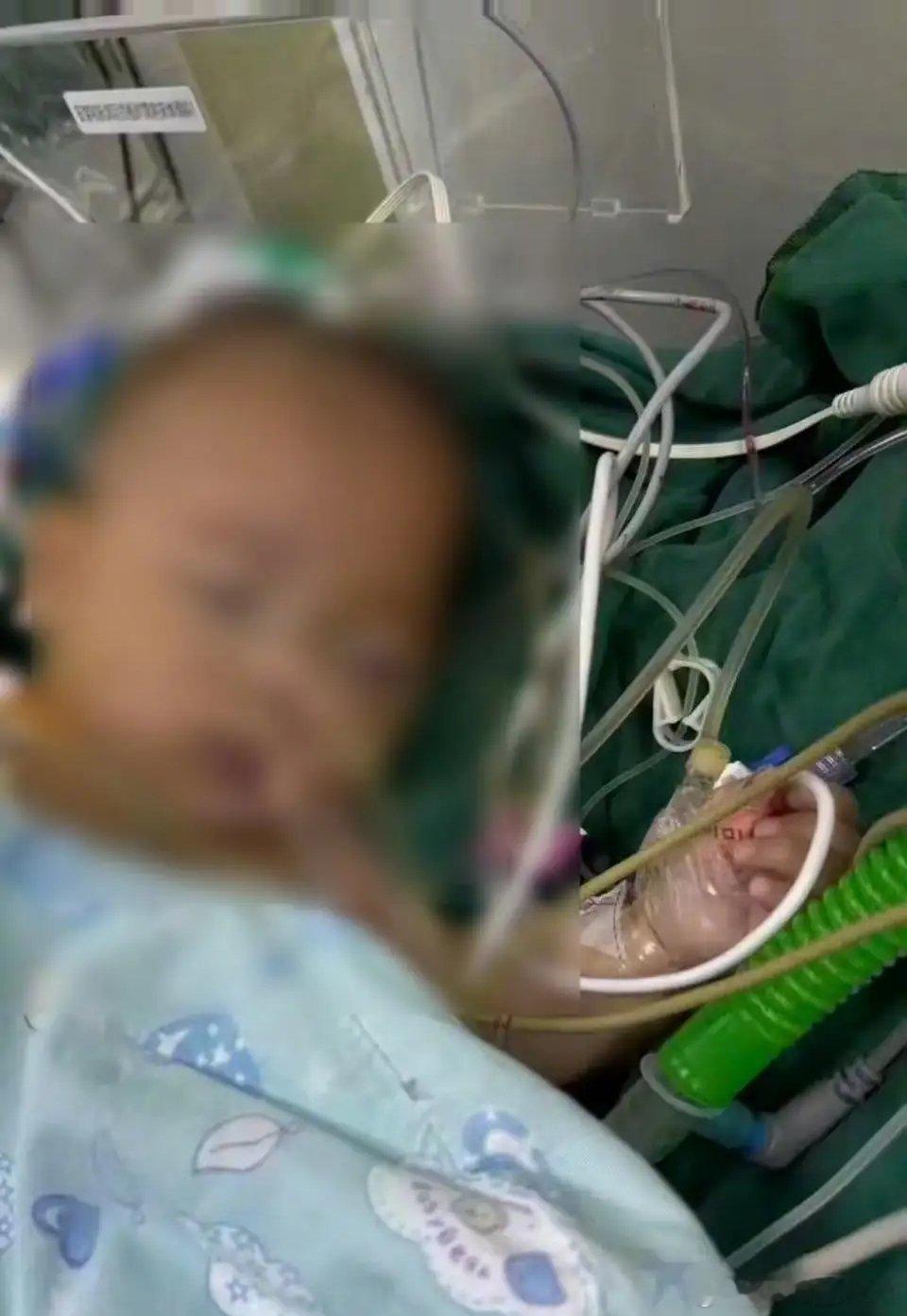 宁波五个月婴儿心脏离世事件，最让我心疼的不是她手术做那么长时间，也不是最后也没能