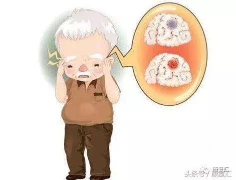 正确认识脑卒中, 7个误区、8个预兆你都知道吗?