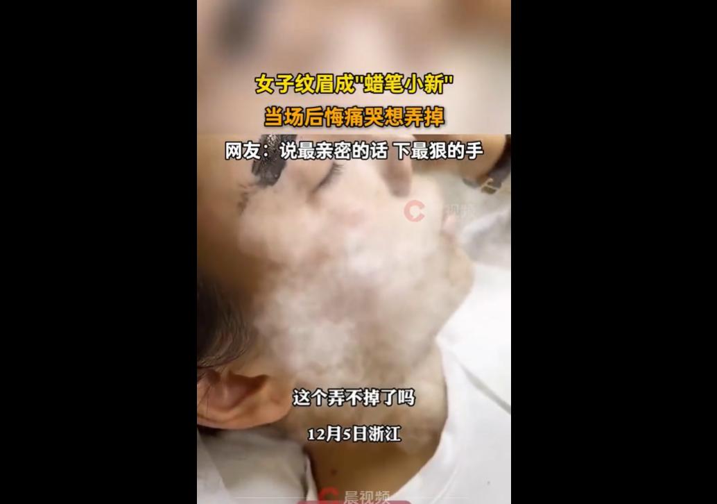 浙江一女子纹眉后效果过粗过黑像“蜡笔小新”，当场崩溃痛哭，视频引热议。不少人