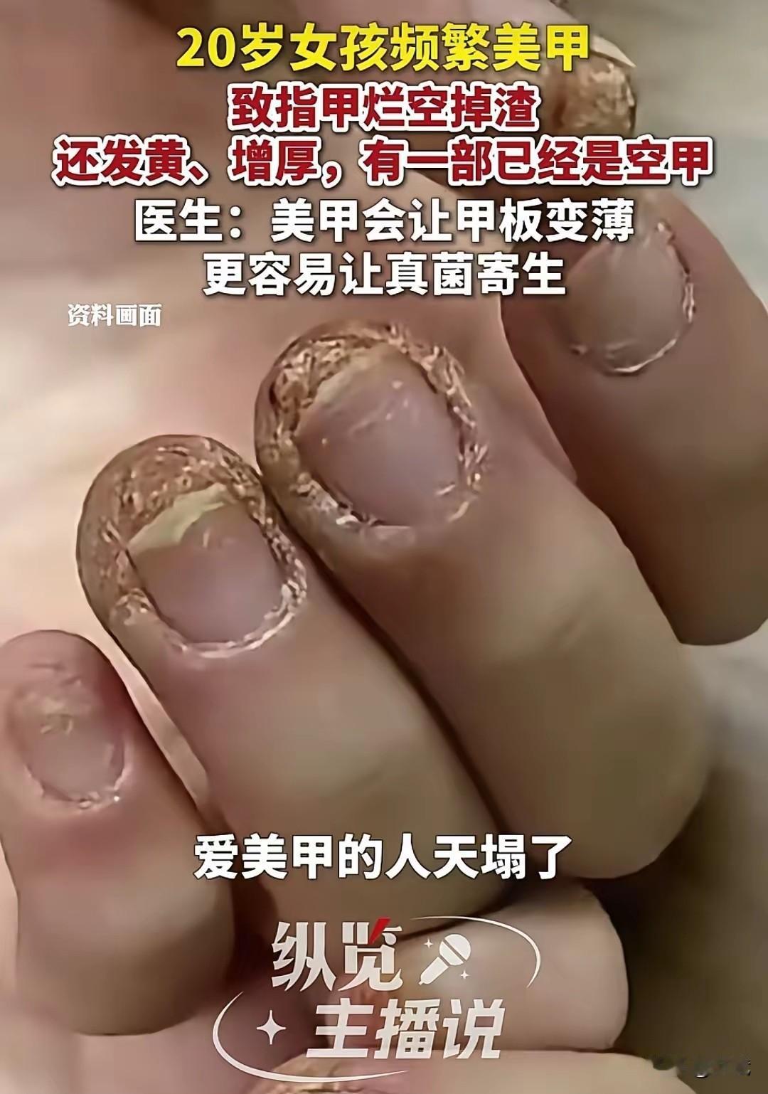 20岁的姑娘，对美甲有着近乎痴迷的热爱，隔三差五就更换美甲款式。每次美甲过程中，