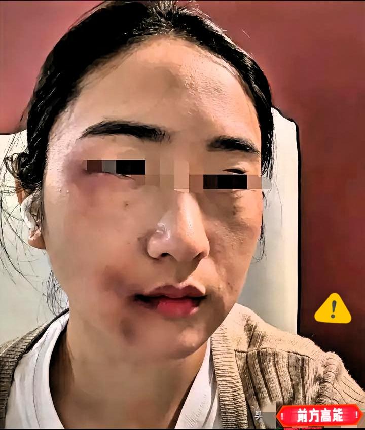 娘家人的钢管，是家暴最好的止痛药昨天被丈夫打了。我弟弟知道以后，从家里拿了