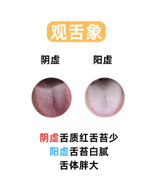 中医舌诊辨证，精准分析体质
