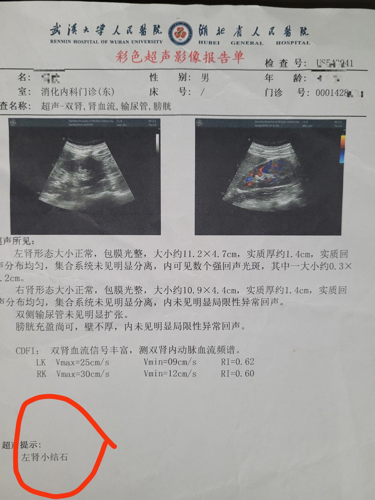 湖北省最好的两家三甲医院，给出的诊断结果“完全相反”，一时间竟不知该相信谁了。此