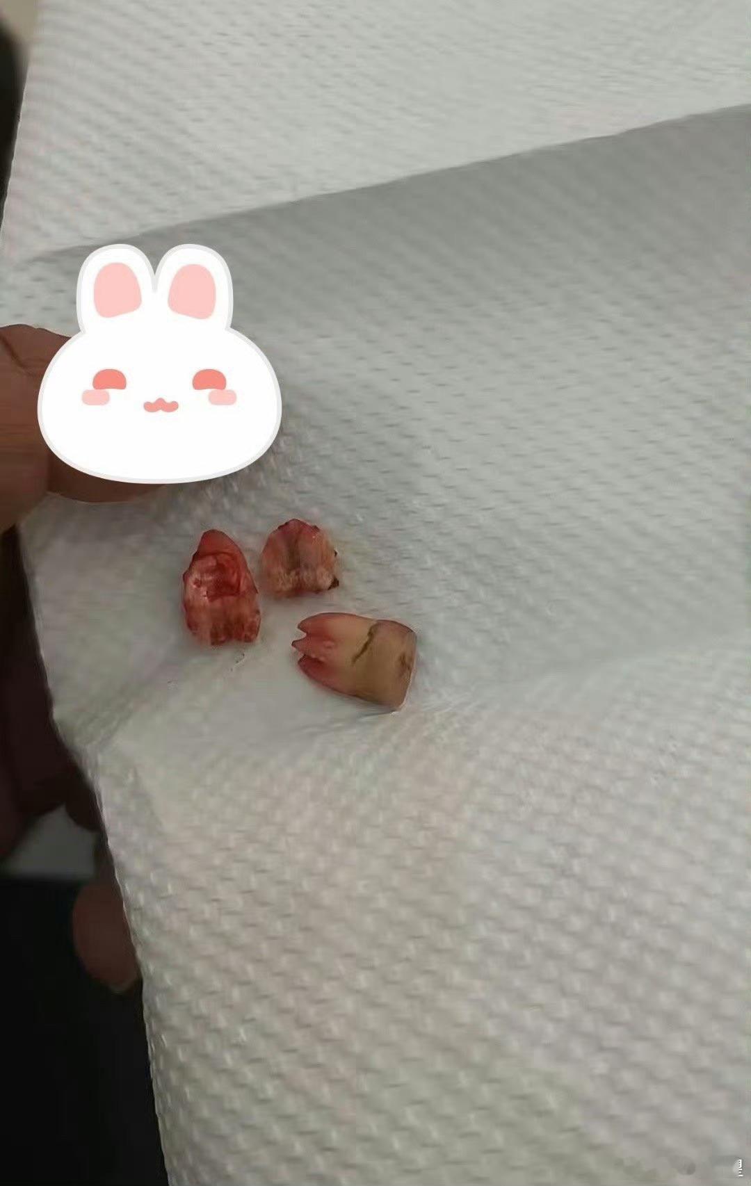 两颗牙对方只赔了62万，感觉亏了啊