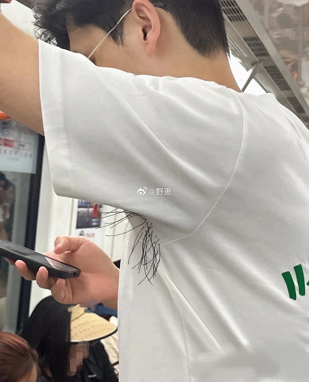 不懂就问，这衣服是设计的还是腋毛穿过了衣服？