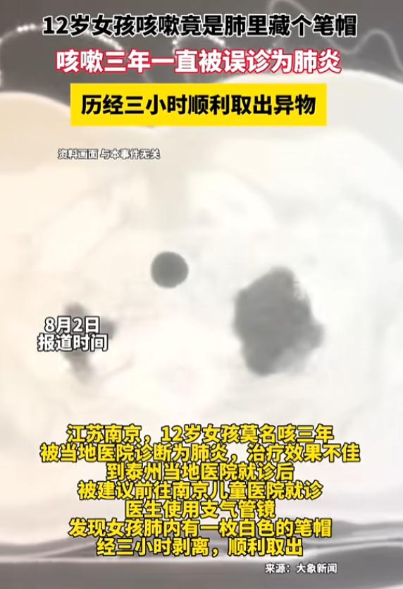 “太震惊了！”8月2日报道，江苏，一12岁女孩莫名其妙咳嗽3年，去医院时被诊断为