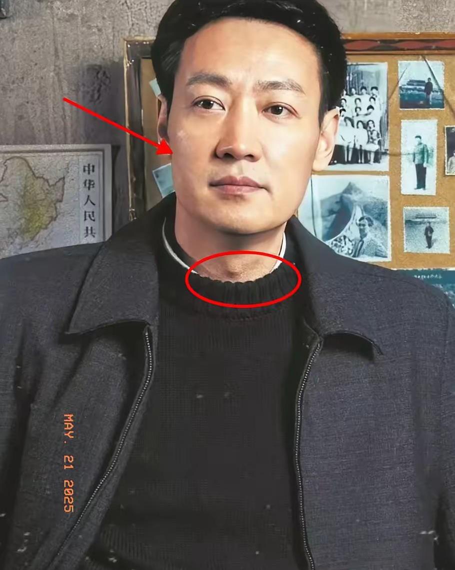 节哀！生活还要继续！