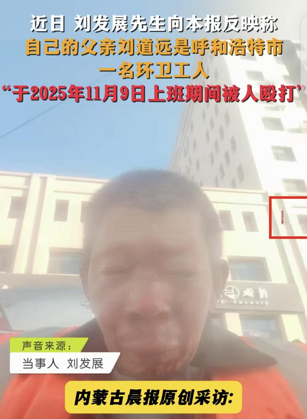 内蒙古，一大爷是环卫工，干活时被一男子莫名其妙打了一顿，视网膜被打落，晶体都取出