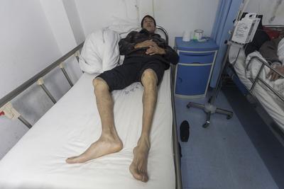 吵架吵到血管“裂开”？江苏这位大哥的经历，真给所有人敲了警钟。江苏的张先生最