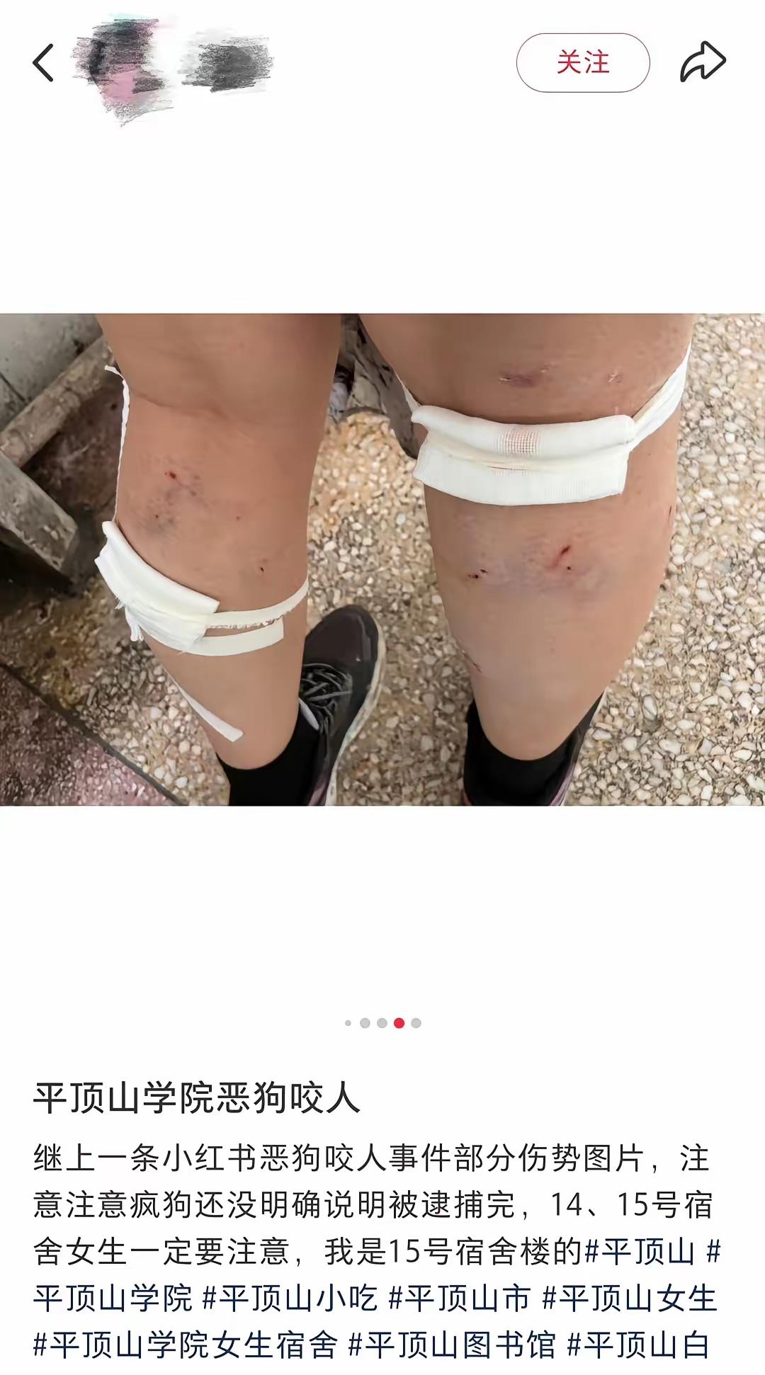 这也叫回旋镖？这不该叫回旋镖吧。平顶山学院2024年开除了清理流浪猫的保安，结