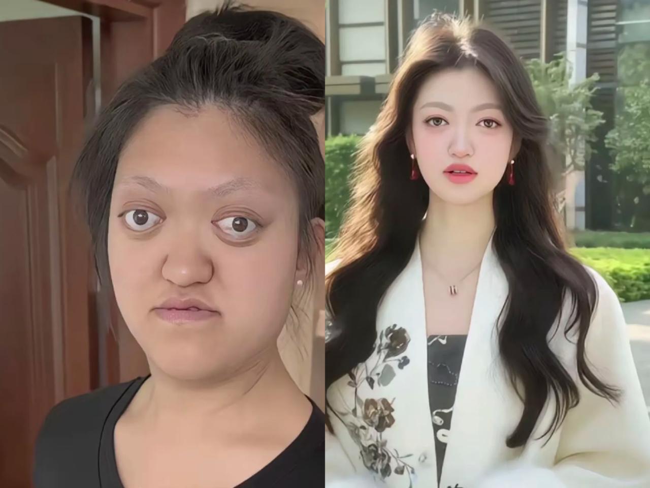 整容的意义，丑小鸭变小天鹅；植发的意义，中年大叔变帅气小伙。先天不足的女生、男生