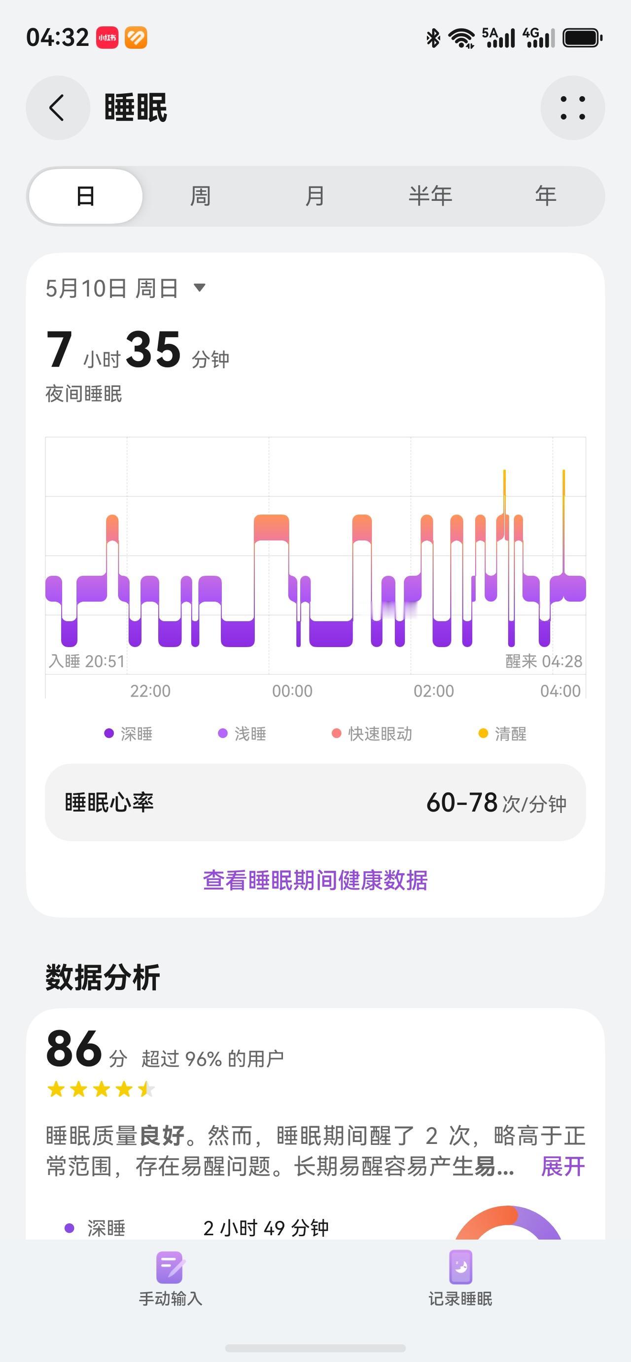 护士日记第二篇昨天晚上睡觉早，破天荒的20点左右。凌晨3点半左右清醒。姑父