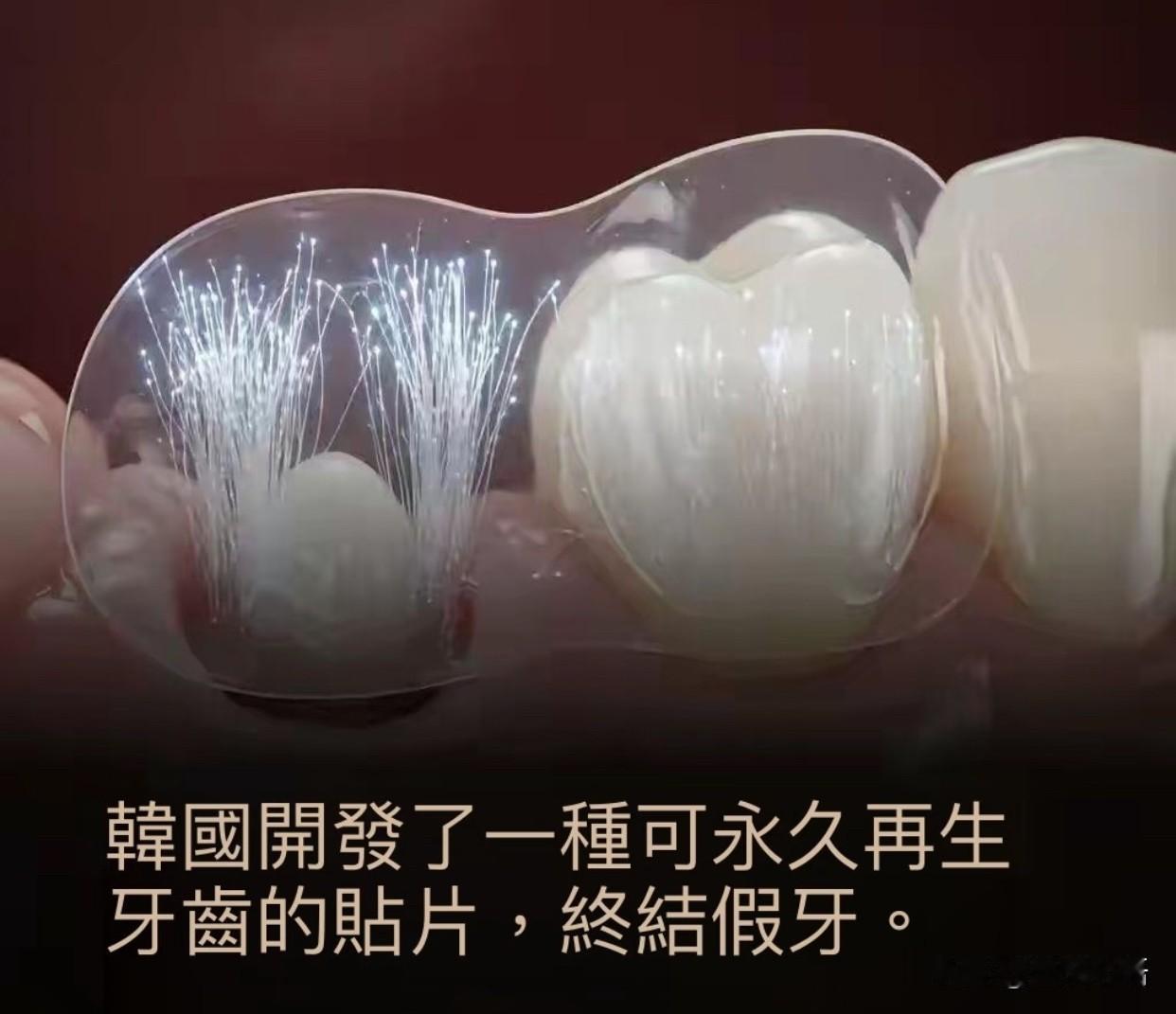 韩国这牙齿贴片！假牙厂老板连夜失眠了谁懂啊！看牙再也不用遭罪了！首尔国立大