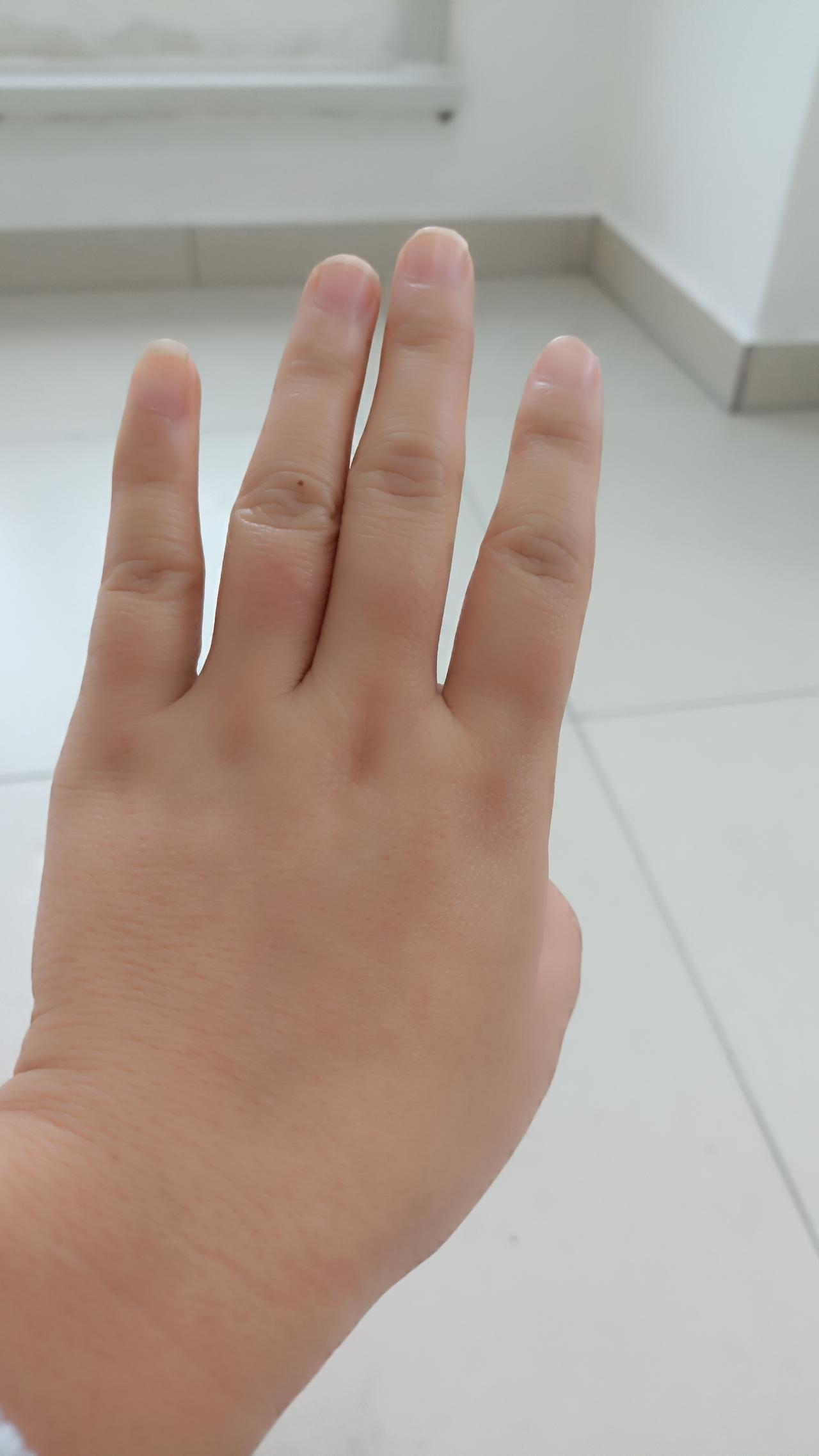 这两天在医院接触了很多护士和医生，都是女人，但是她们的手部状态有明显区别。医生