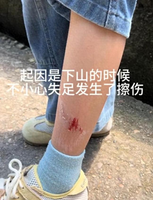 太炸裂了！江西女子五一假期带女儿爬龟峰，孩子小腿刮伤，景区大叔见状主动帮忙擦碘伏