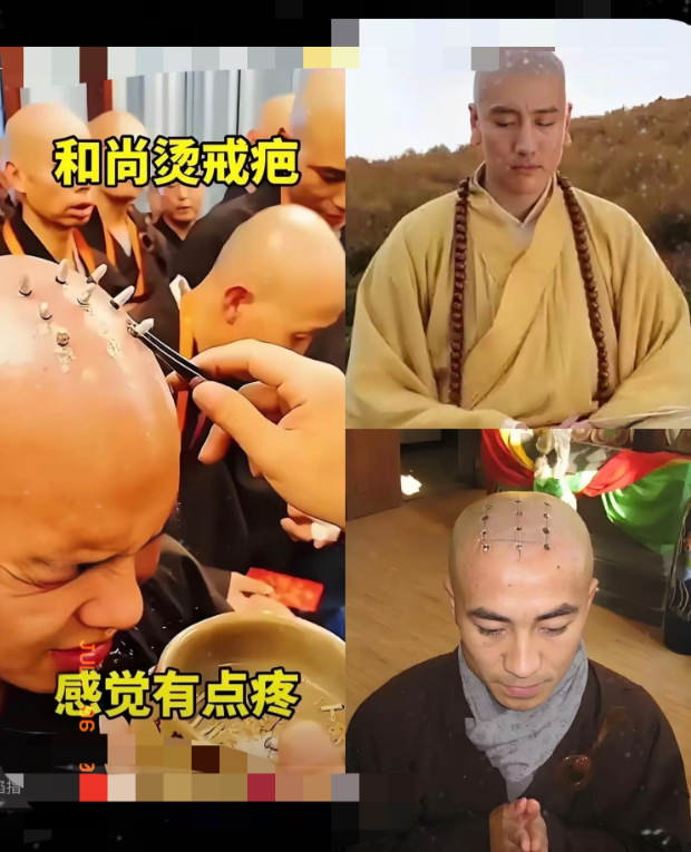 来自基层的呼声火了：强烈建议佛教恢复戒疤！这事儿可不简单，戒疤在