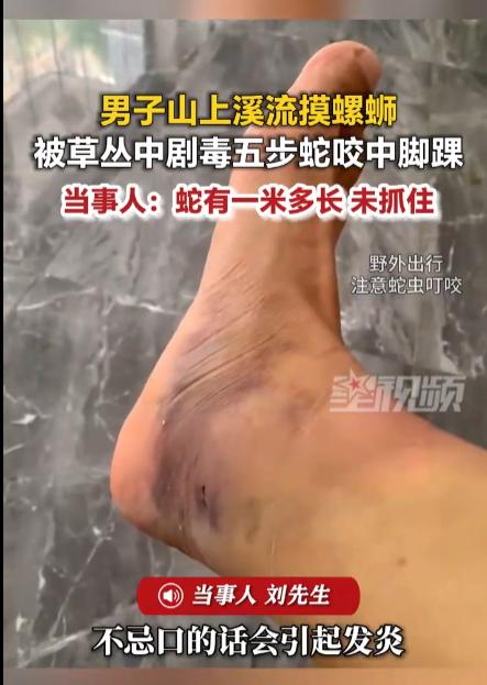 “这也太让人后怕了！”浙江丽水，男子在山间溪流摸螺蛳时，脚踝突遭草丛中剧毒五步蛇