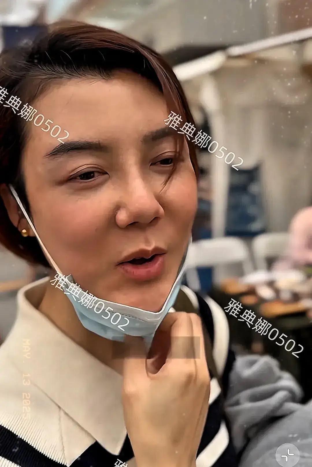 她是早期就开始整容失败的例子，叫啥晓？
