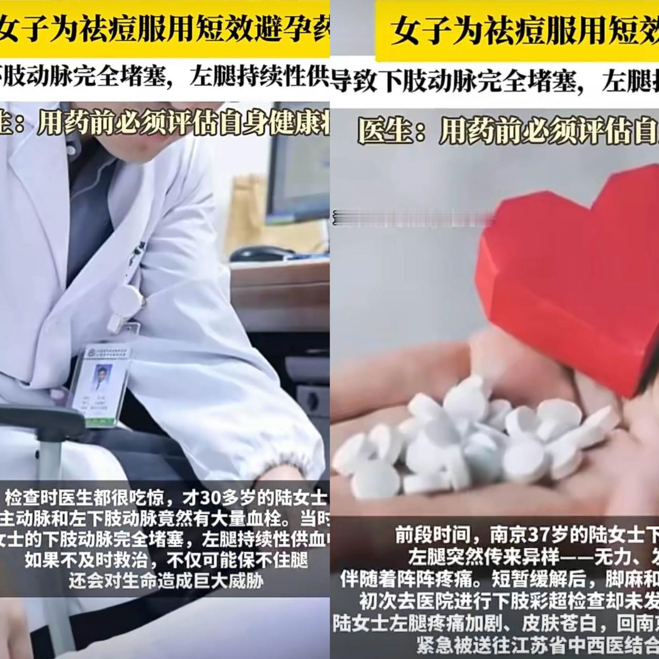 “这下肠子都悔青了吧！”南京一名37岁的女子为了治疗自己的痘痘，竟连续吃了一个多