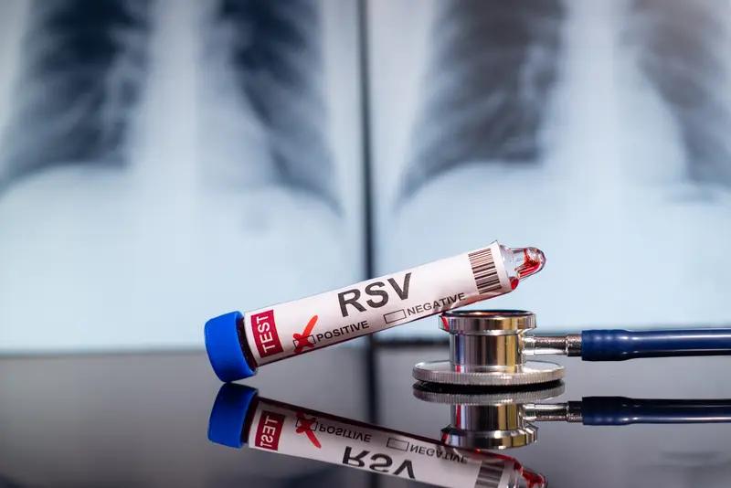 乳头状甲状腺癌的生存率相对较高。一般来说，早期发现并治疗的乳头状甲状腺癌患者，1