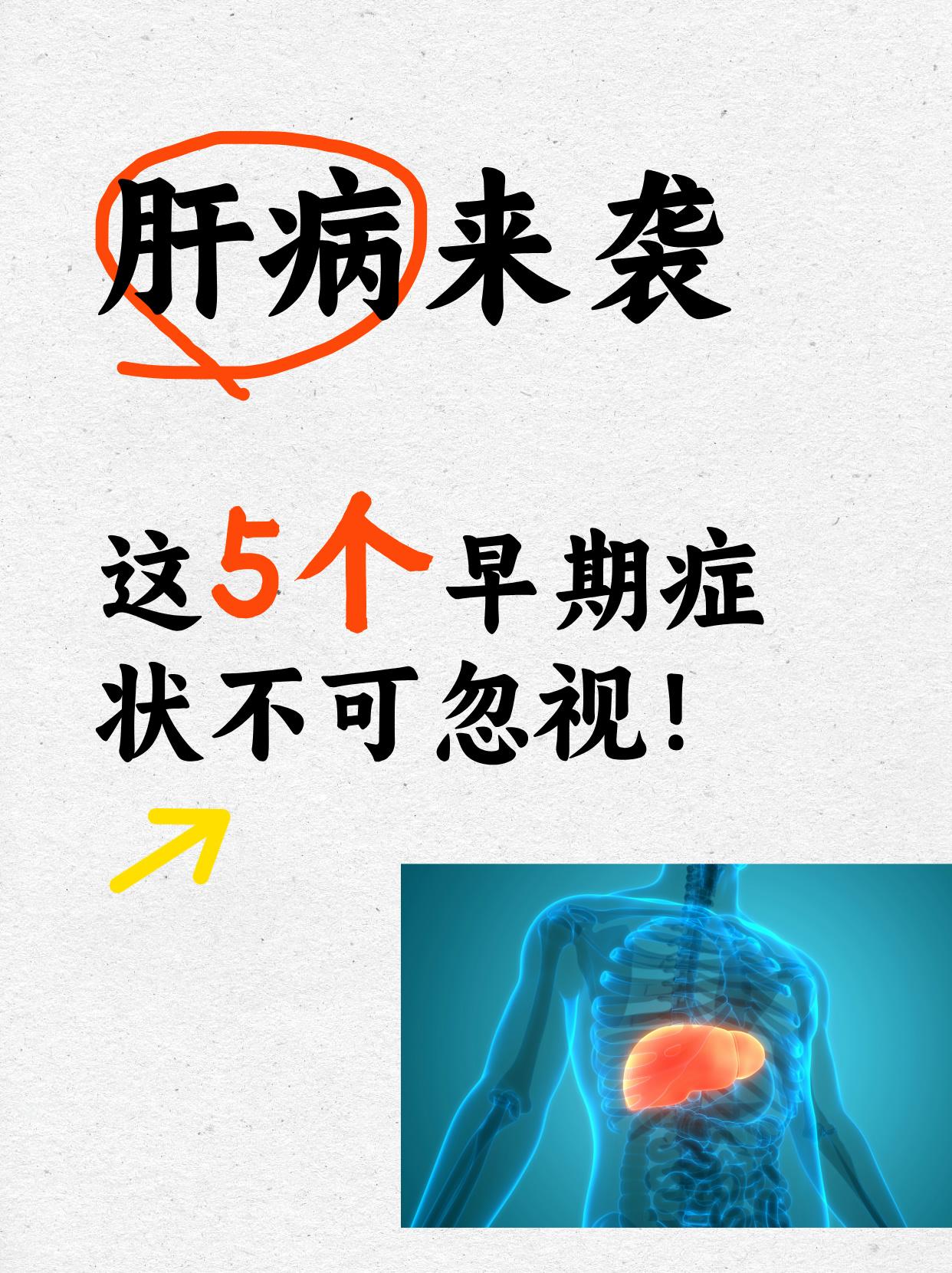 肝病来袭，这5个早期症状不可忽视！肝脏疾病是五花八门的，每个人可能出现的症状