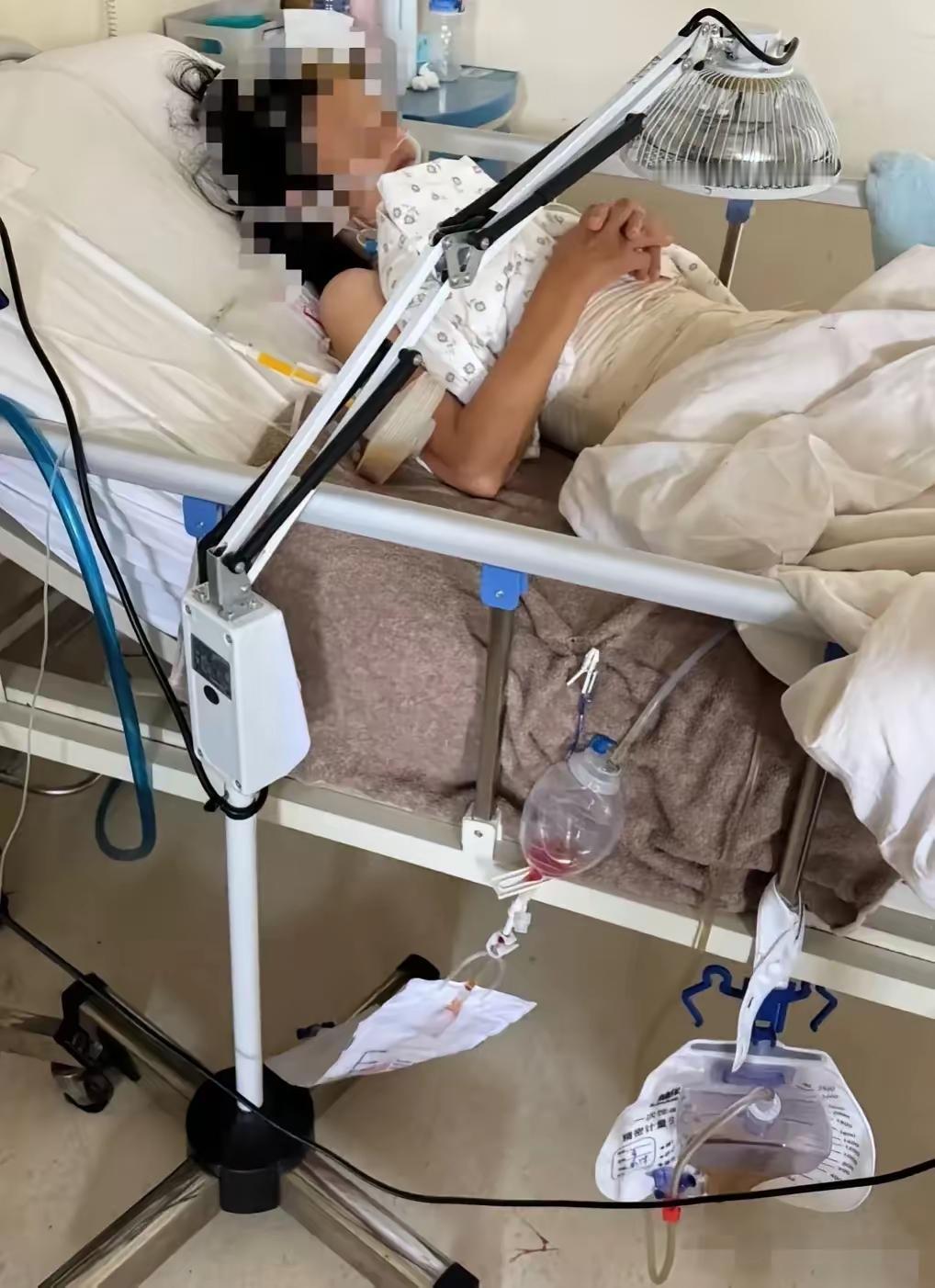 我姐家儿媳妇，今年36岁，2025年6月27号，因为高血压，没吃降压药导致突发脑