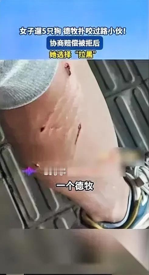 深圳这女的太横了！遛5条狗咬了人，转头就拉黑？那天等红绿灯，她一个人牵著德牧
