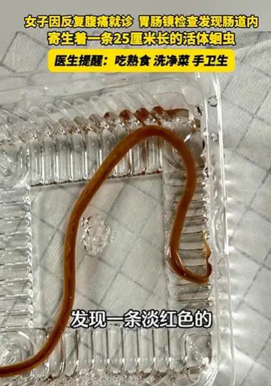 我总觉得，这条虫子给很多人大意的生活提了个醒。浙江一位王女士连续腹痛多日