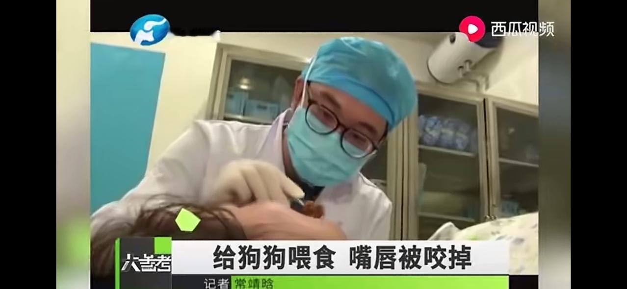 女士嘴唇被狗咬掉吃了！一位女士在喂狗的时候，狗的性情突然发作，将该