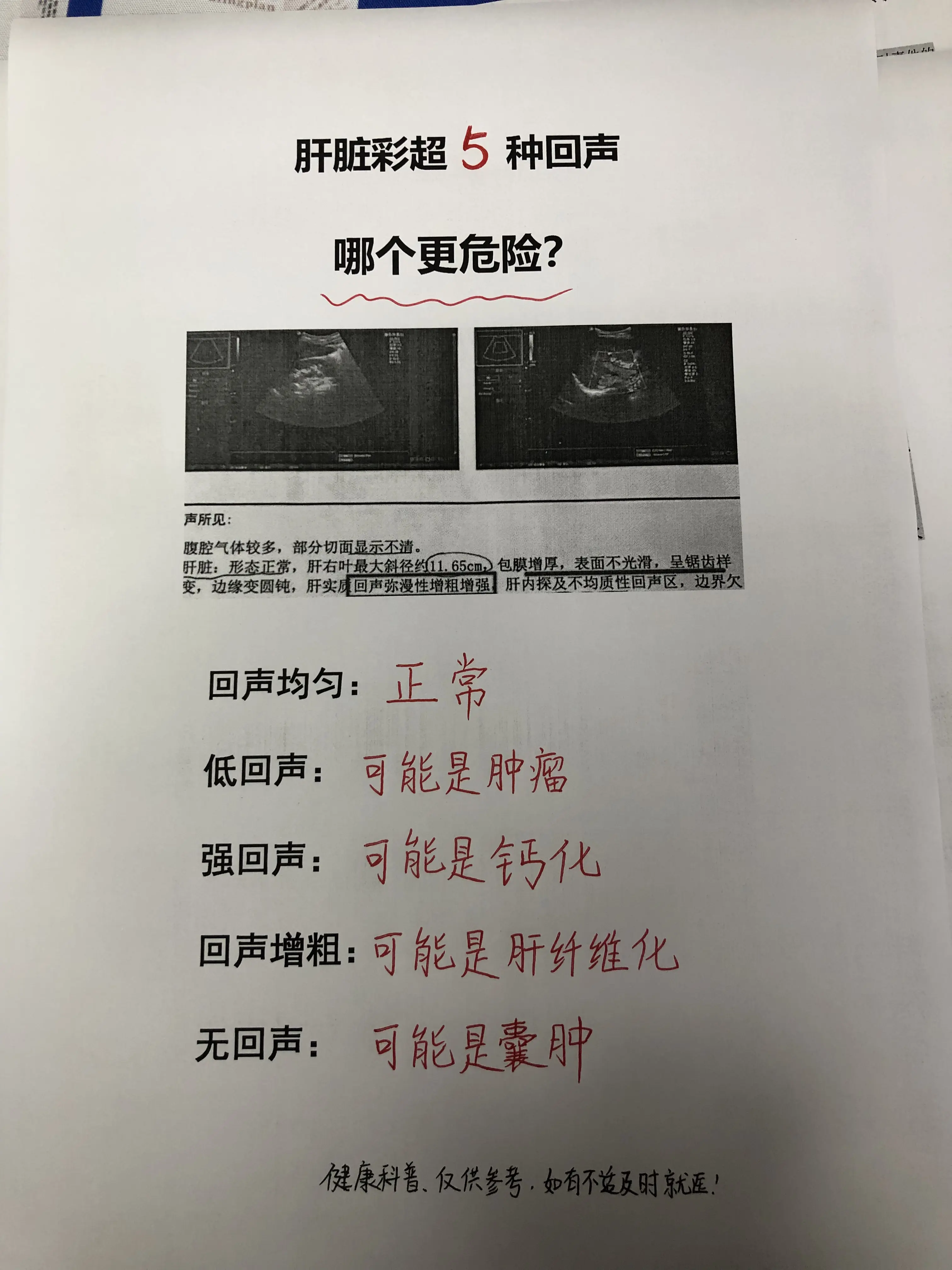 乙肝 肝脏彩超 回声增粗 肝纤维化 肝病教授陈士俊